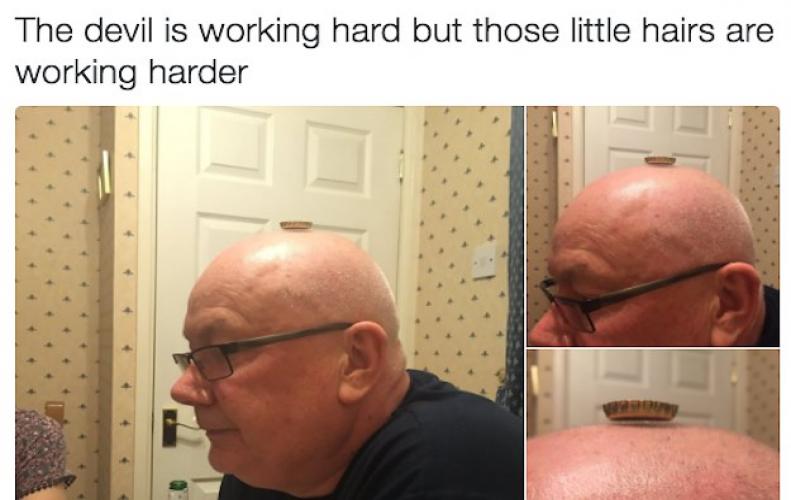 Weird Pictures | Weirdest Thing You will See Today on Internet