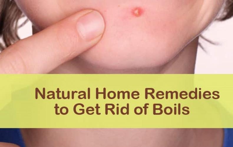 Natural Home Remedies to Overcome Painful Heat Boils